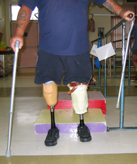 Early Prosthetic Mobility Early Prosthetic Mobility